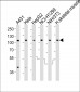 ACTN2 Antibody (Center)